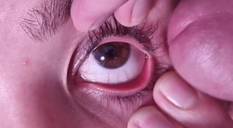 Cum dumpster gets a full cumshot into her open eye | talking