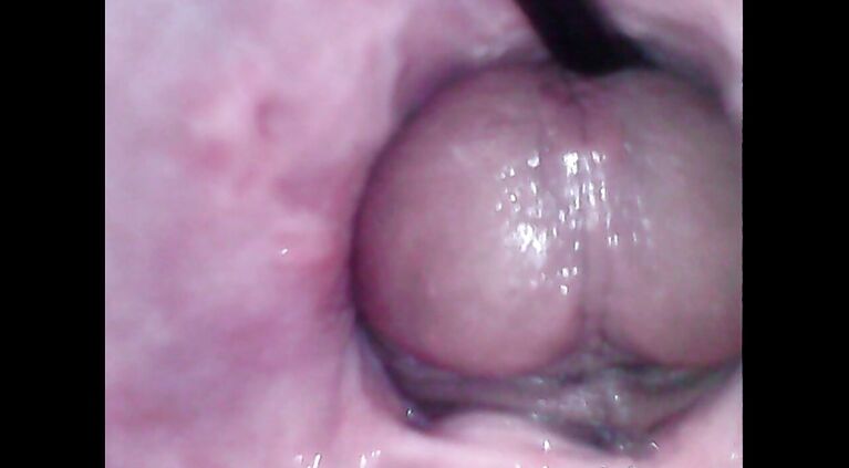 fucking my wife with a camera inside her vagina